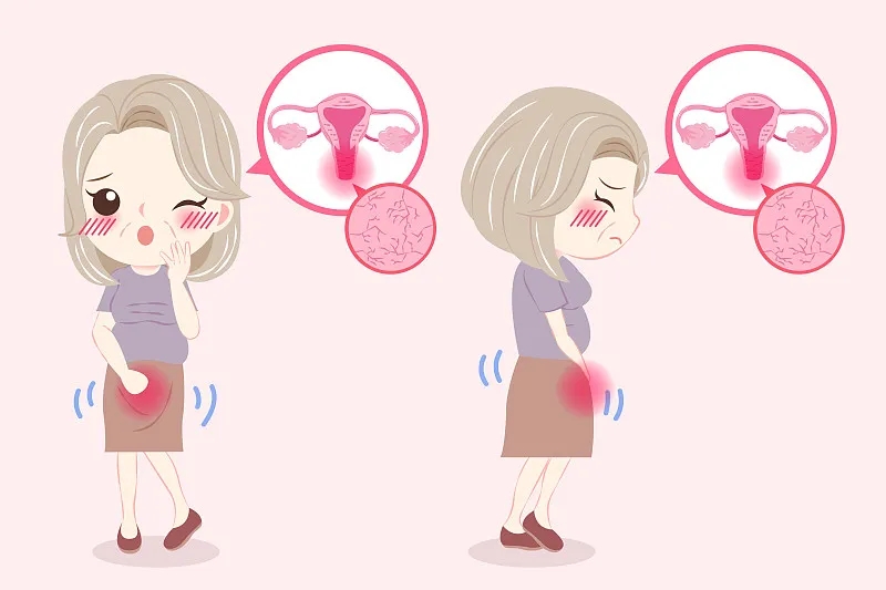 原發(fā)性卵巢功能不全：原因、癥狀和治療