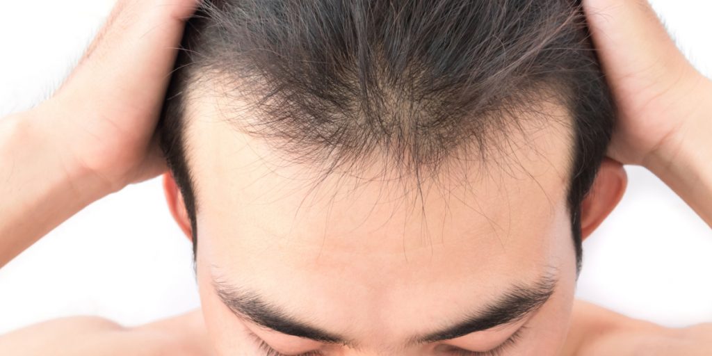 干細胞可以再生頭發(fā)嗎？