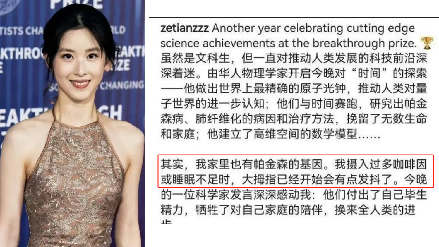 章澤天自曝有帕金森病家族史，干細胞療法讓年輕人不再懼“帕”