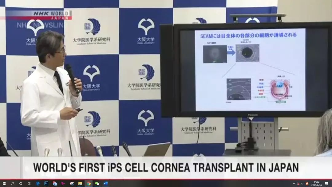 干細胞治療角膜疾病臨床案例 干細胞治療角膜疾病臨床案例