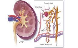 狼瘡性腎炎的診斷方法 狼瘡性腎炎的診斷方法