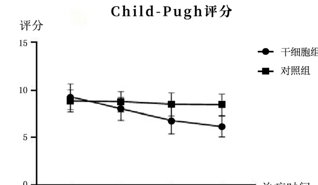 2005年干細胞治療肝硬化臨床案例 2005年干細胞治療肝硬化臨床案例