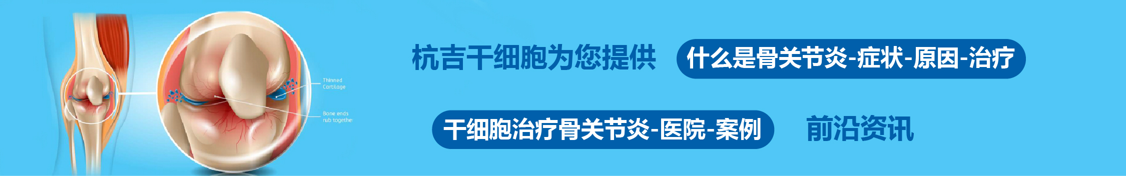 國內外干細胞醫院治療骨關(guān)節炎的臨床案例