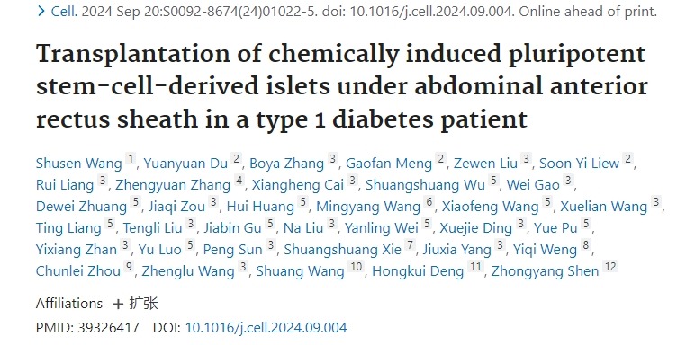 1型糖尿病患者腹部前直肌鞘下化學(xué)誘導多能干細胞來(lái)源的胰島移植
