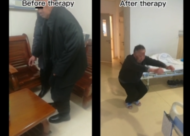患者4 患者4